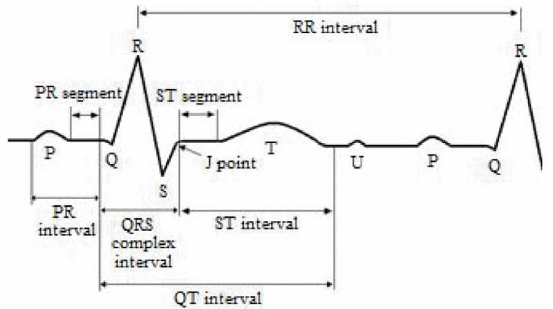 File:ECG waveform.gif